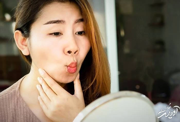 درمان لاغری صورت با تمرینات لپ و گونه راه درمان لاغری صورت